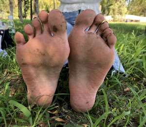 淑芬大腿内又痒了